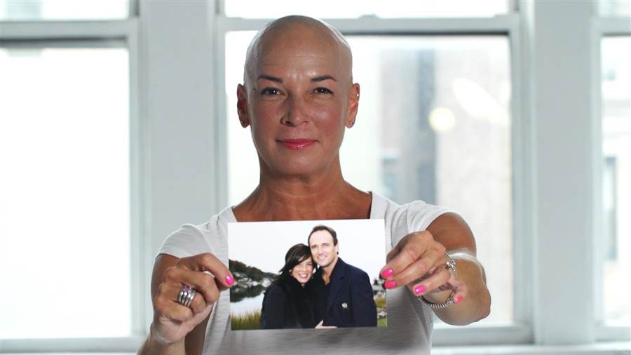  stop 
      balding now